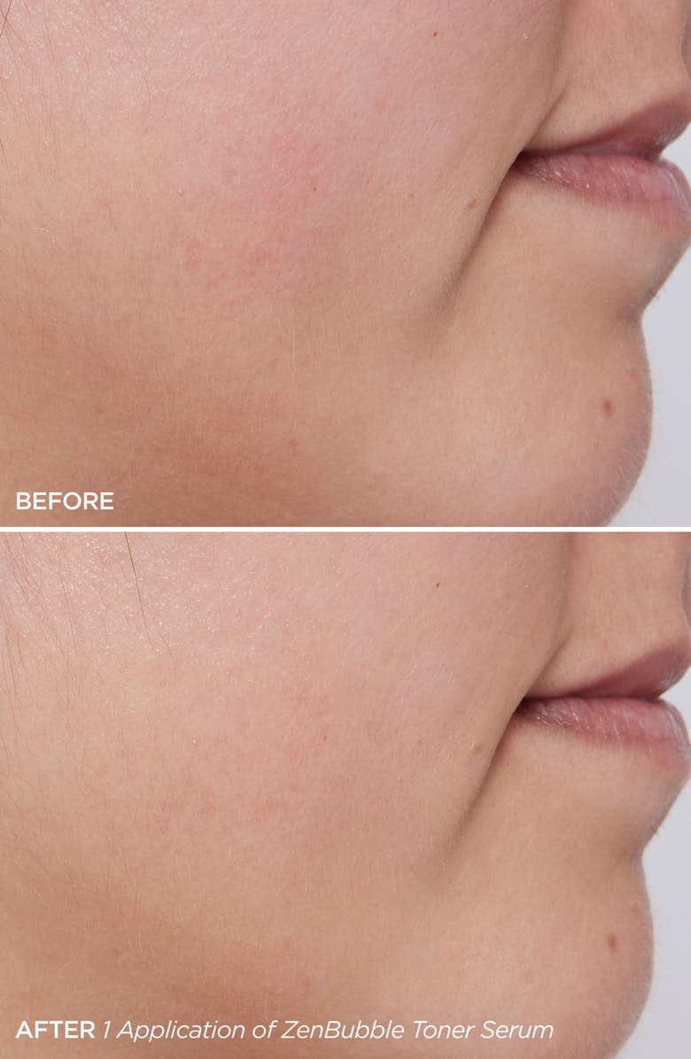 BeautyBio ZenBubble Bi-Phase Toner Serum, Alternate, color,