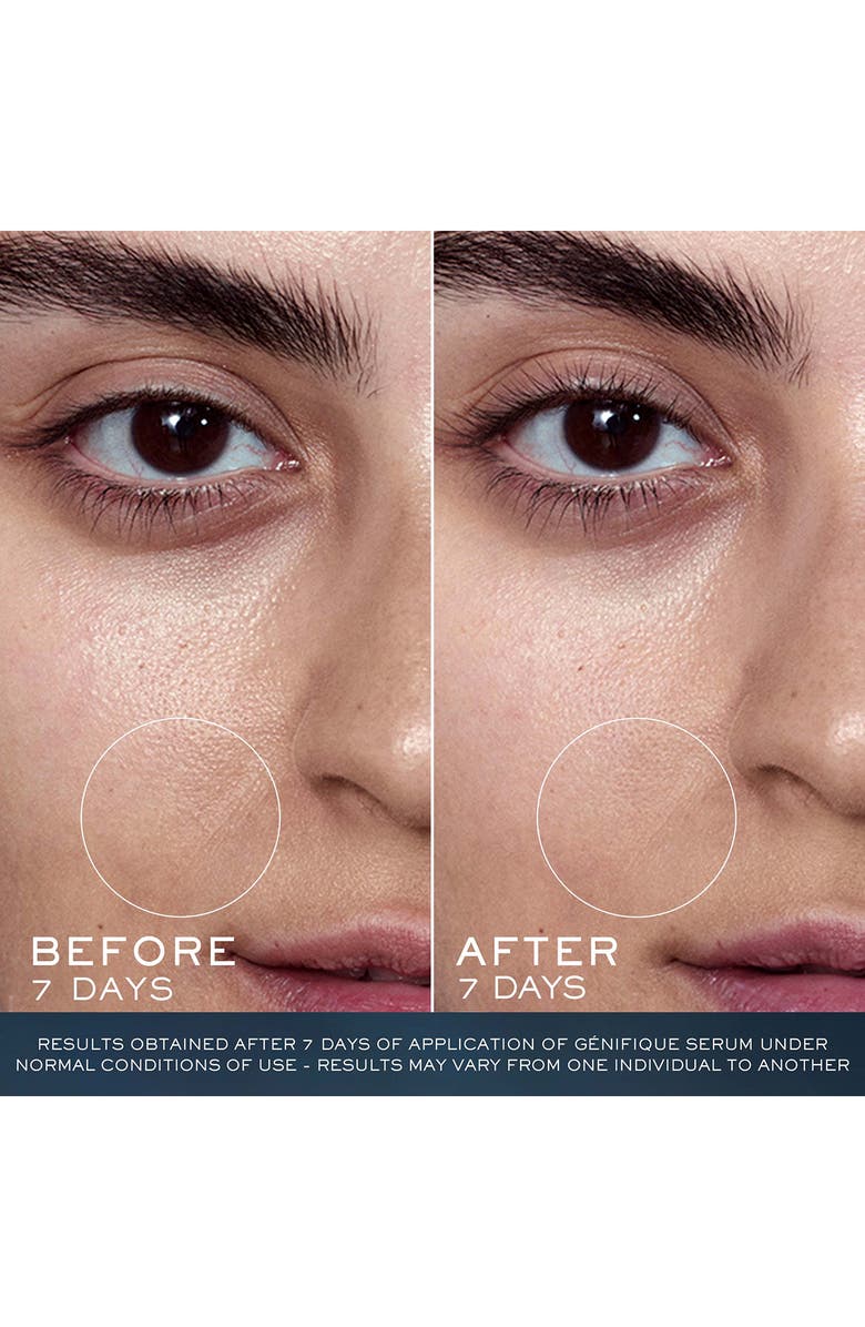 Lancôme Strengthening & Repairing Trio Set (Limited Edition) USD $217 Value, Alternate, color,