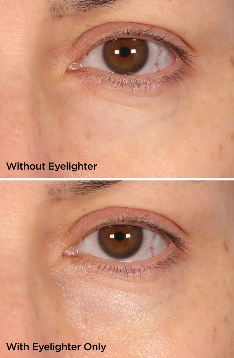 BeautyBio The Eyelighter Concentrate Smoothing, Brightening Serum & Depuffing Tool, Alternate, color,