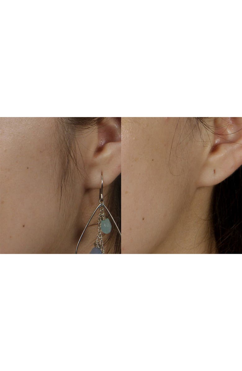 Silk'n Flash & Go Express Hair Removal Device, Alternate, color,