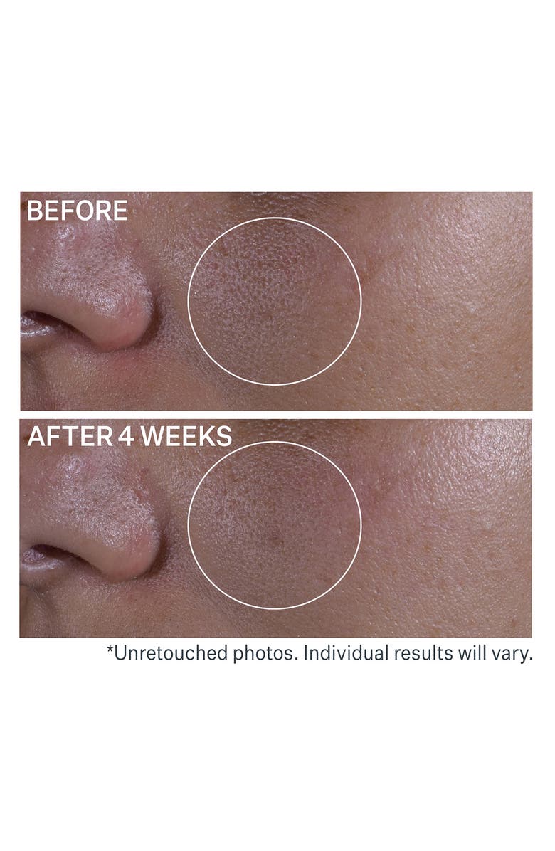 StriVectin<sup>®</sup> Super Shrink Pore Minimizing Serum, Alternate, color, 