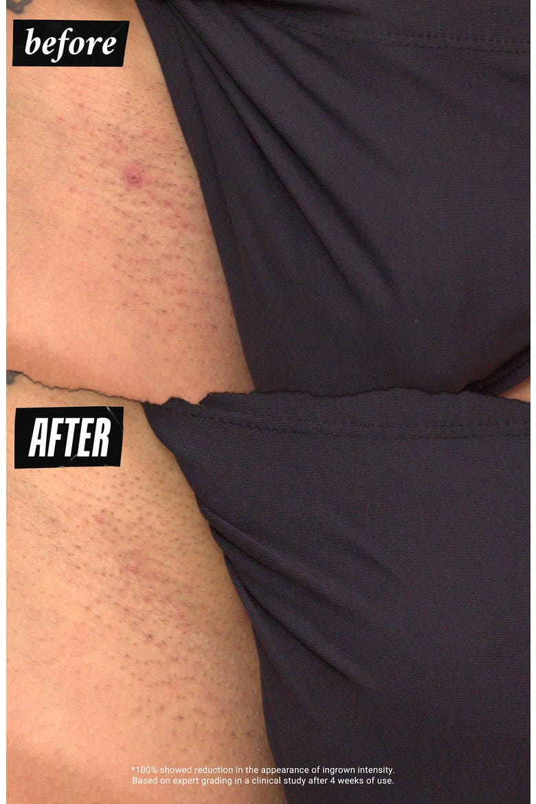 Ingrown Hair & tone-Correcting Intimate Drops, Alternate, color, NO COLOR