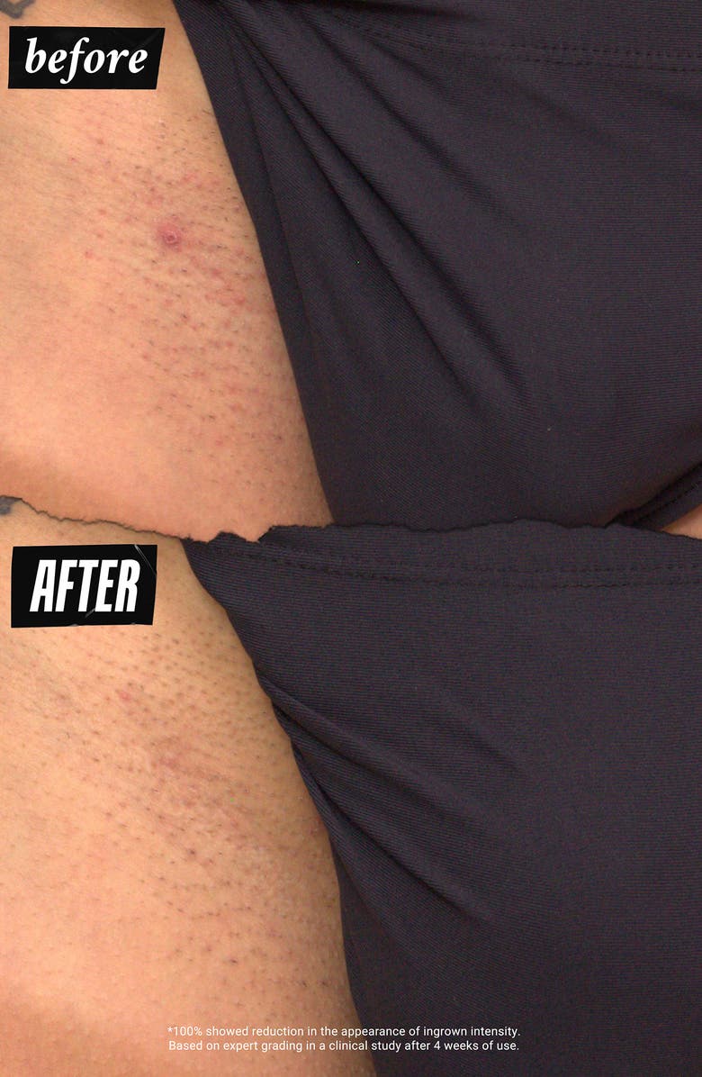 Kiehl's Since 1851 Ingrown Hair & tone-Correcting Intimate Drops, Alternate, color,