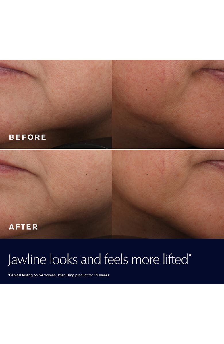 Estée Lauder Revitalizing Supreme+ Youth Power Cream Moisturizer Refill with Hyaluronic Acid & Peptides, Alternate, color,