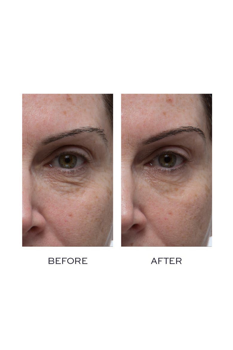 Peptide4 Eye Recovery Cream, Alternate, color, NO COLOR