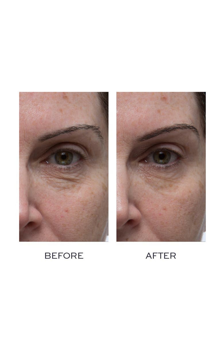 Elemis Peptide4 Eye Recovery Cream, Alternate, color,