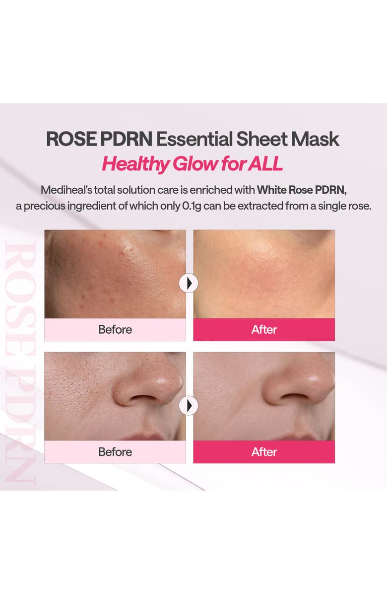 MEDIHEAL Rose PDRN Essential Mask Set, Alternate, color, Dark Red