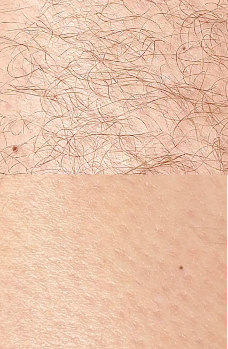 ANSWR Exfoliating Hair Removal Drop, Alternate, color, 