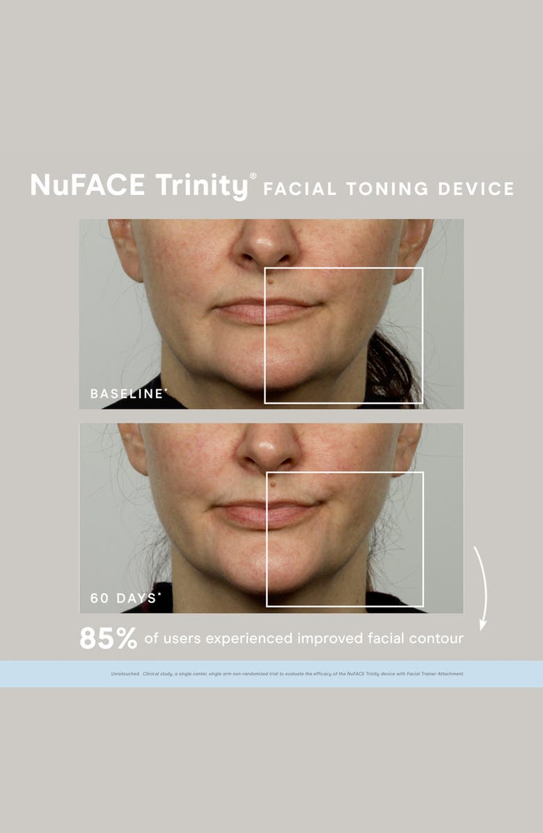 NuFACE<sup>®</sup> Trinity<sup>®</sup> Skin Care Regimen Set (Limited Edition) USD $473 Value, Alternate, color, 