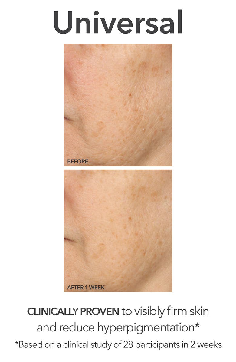 Dr. Dennis Gross Skincare Glow, Brighten & Smooth Set $245 Value, Alternate, color,