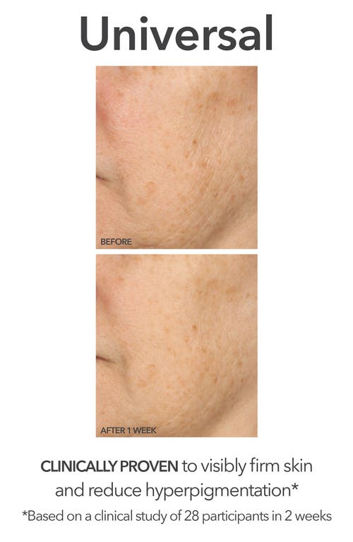Dr Dennis Gross Skincare Dr. Dennis Gross Skincare Glow, Brighten & Smooth Set $245 Value