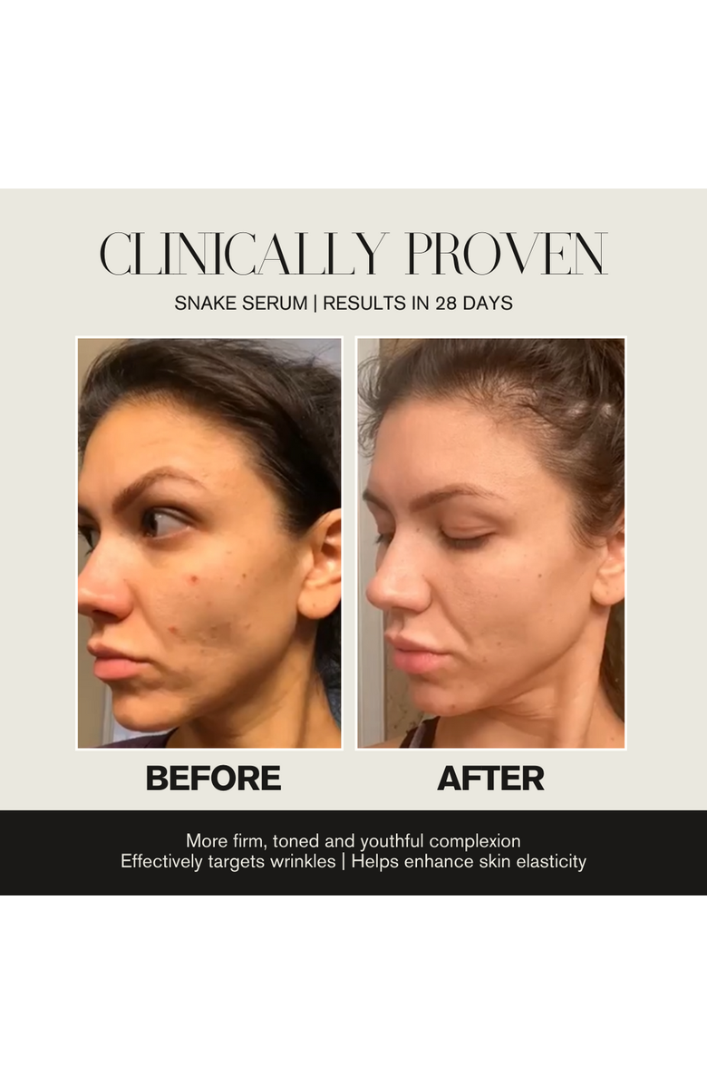 Intoxicated Cosmetics Snake Serum + Antidote Moisturizer | Anti-Aging Formula with Vegan Snake Peptides &  Fine Line Smoothing in a Hydrating Daily Moisturizer, Alternate, color, NO COLOR