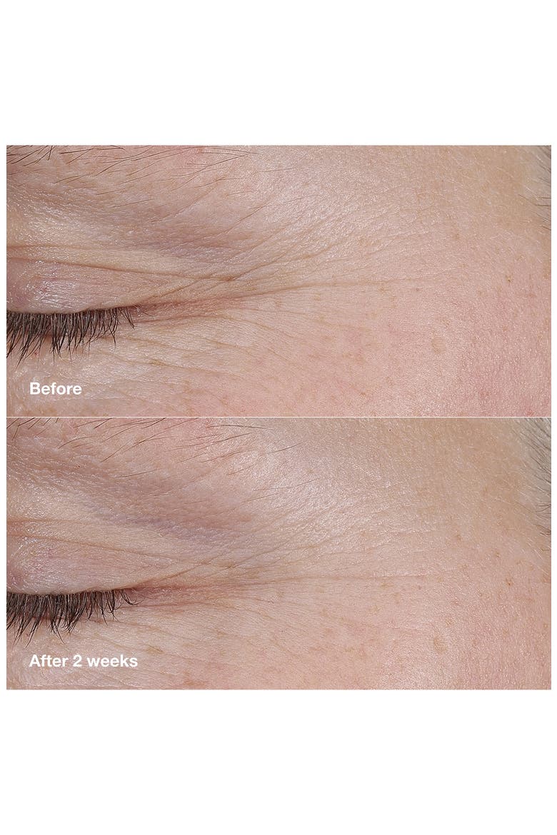 Smart Clinical Repair AM/PM Retinoid Balm, Alternate, color, NO COLOR