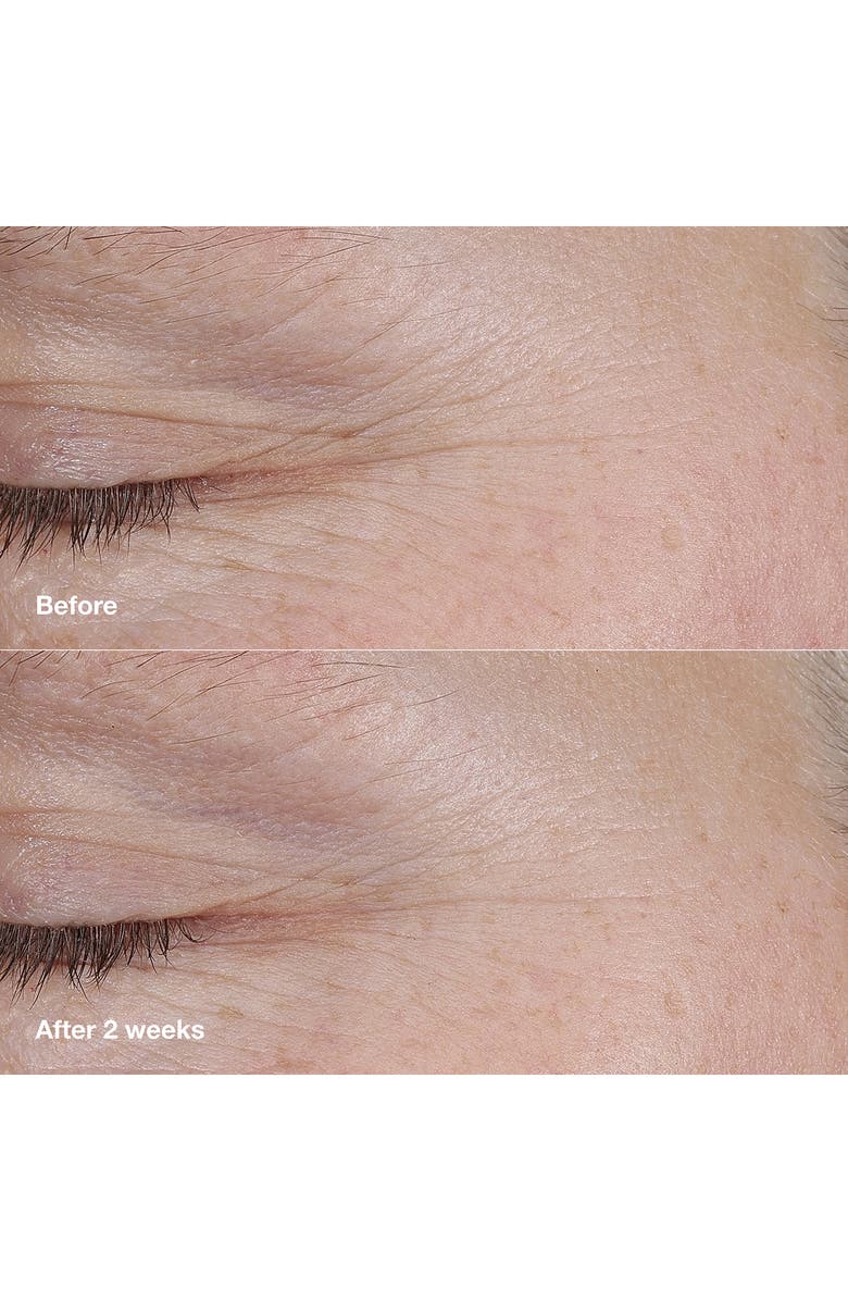 Clinique Smart Clinical Repair AM/PM Retinoid Balm, Alternate, color,