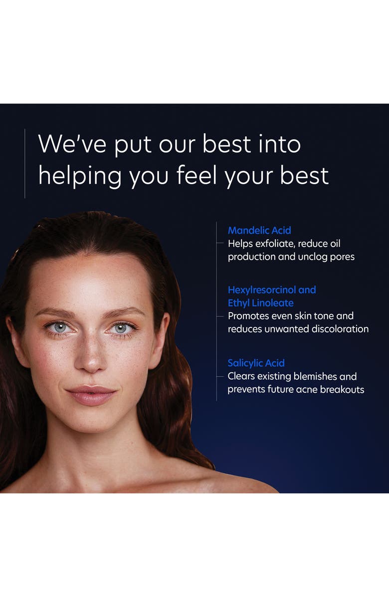 PCA Skin Acne Gel, Alternate, color, 