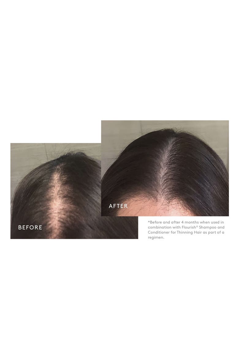 Flourish Minoxidil Topical Aerosol 5% Hair Regrowth Treatment for Women, Alternate, color, NO COLOR