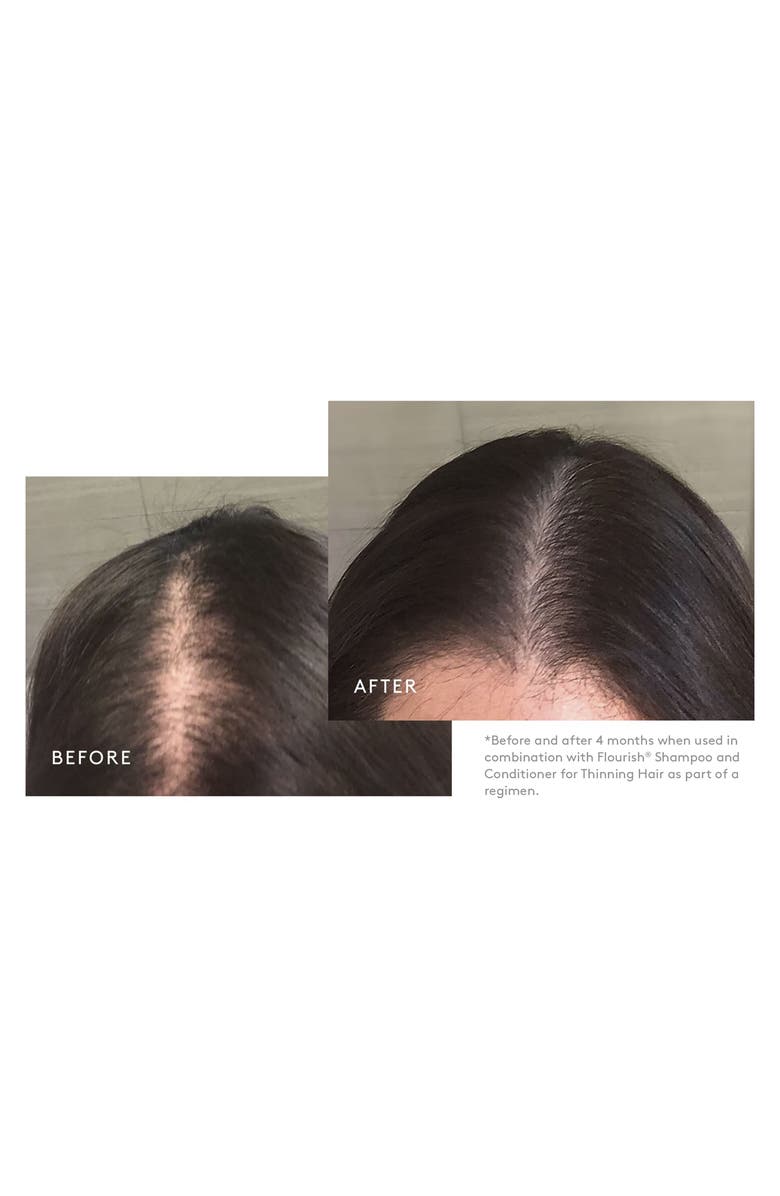 Virtue<sup>®</sup> Flourish Minoxidil Topical Aerosol 5% Hair Regrowth Treatment for Women, Alternate, color, 