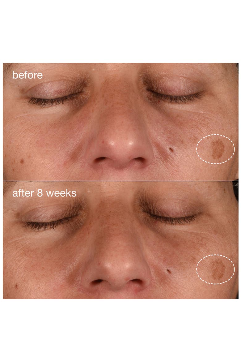Dynamic Skin Recovery SPF 50 Moisturizer, Alternate, color, NO COLOR