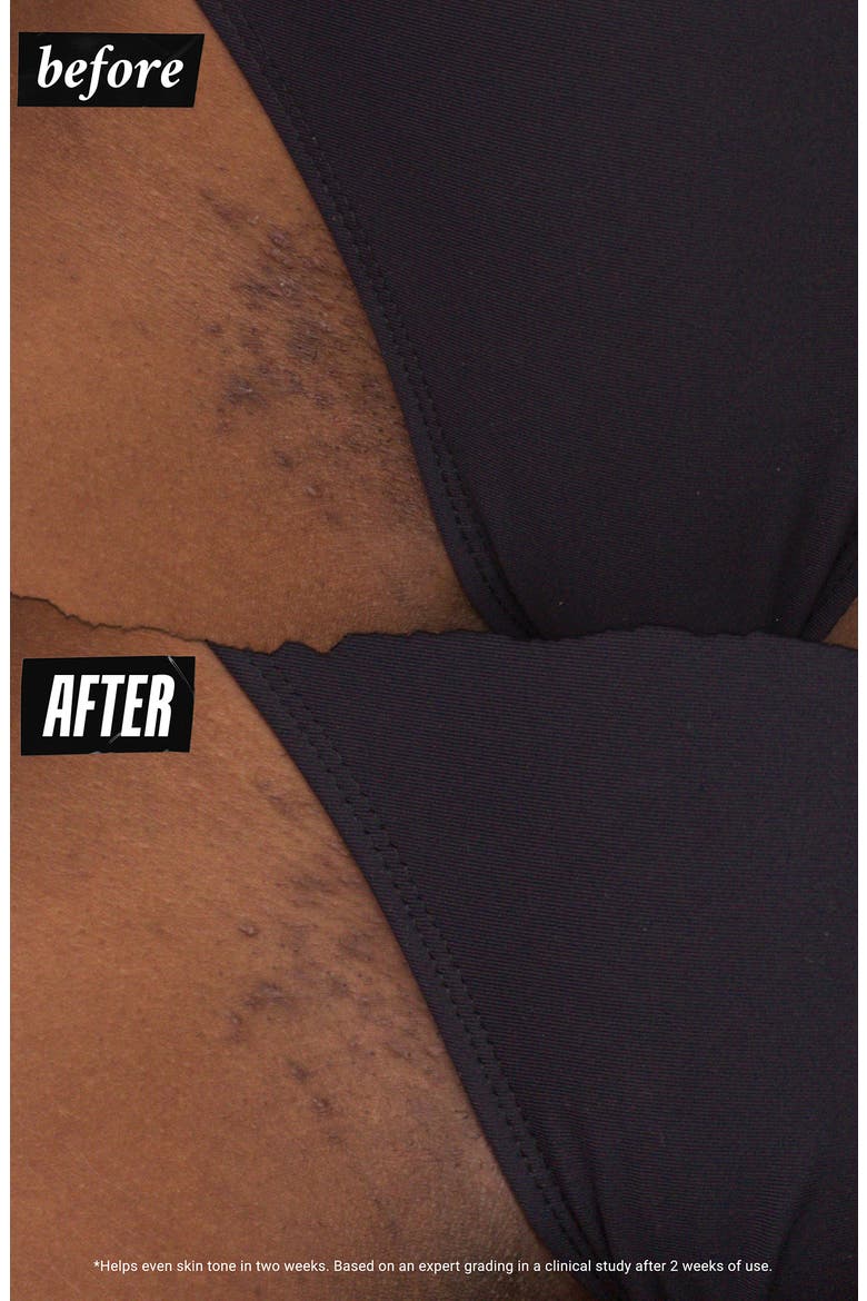 Ingrown Hair & tone-Correcting Intimate Drops, Alternate, color, NO COLOR