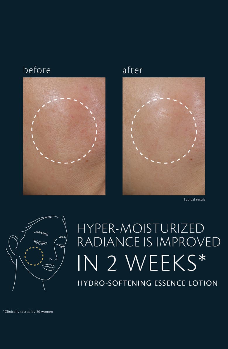 Clé de Peau Beauté Hydro-Softening Essence Lotion, Alternate, color, Regular