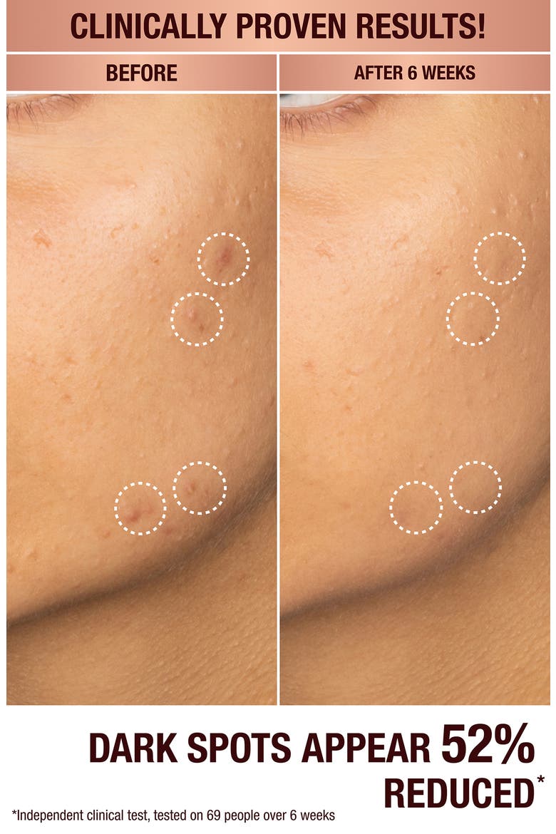 Dark Spot Correcting Radiance Recovery Serum (Nordstrom Exclusive), Alternate, color, NO COLOR