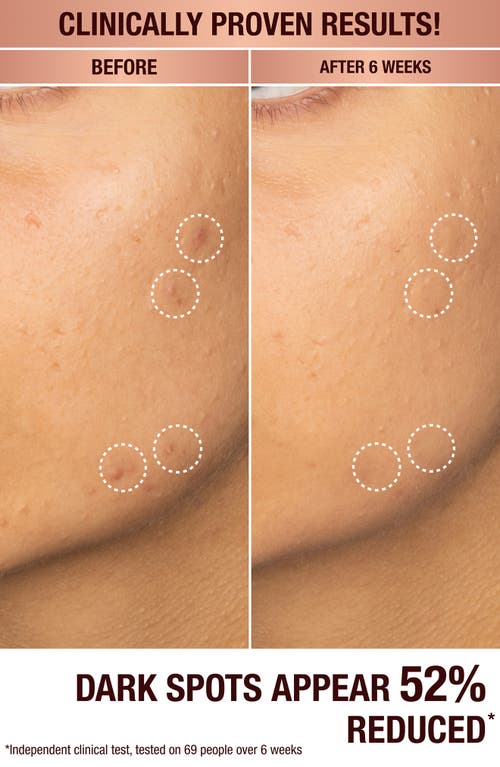 Charlotte Tilbury Dark Spot Correcting Radiance Recovery Serum