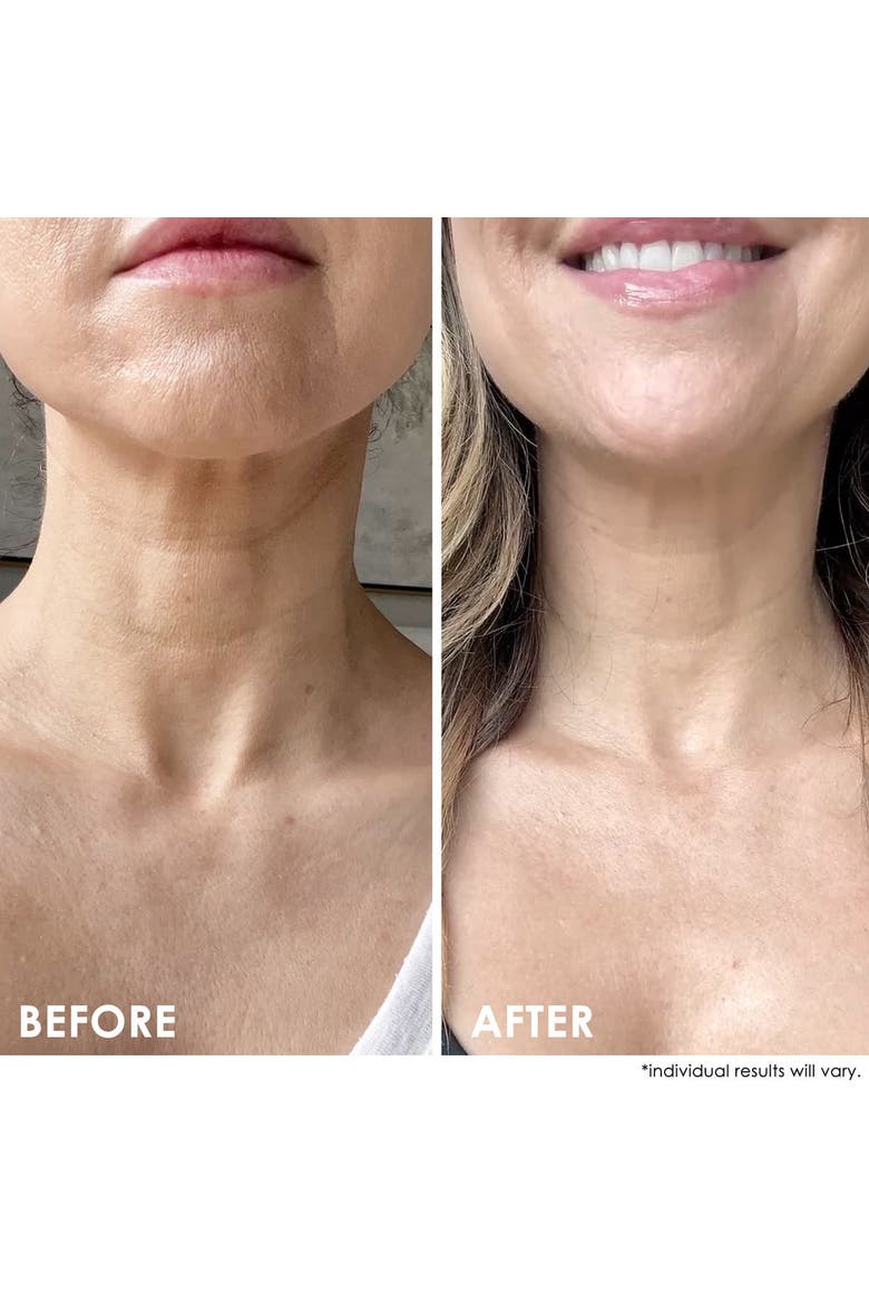 SELF-ESTEEM Neck Firming Lift, Alternate, color, White