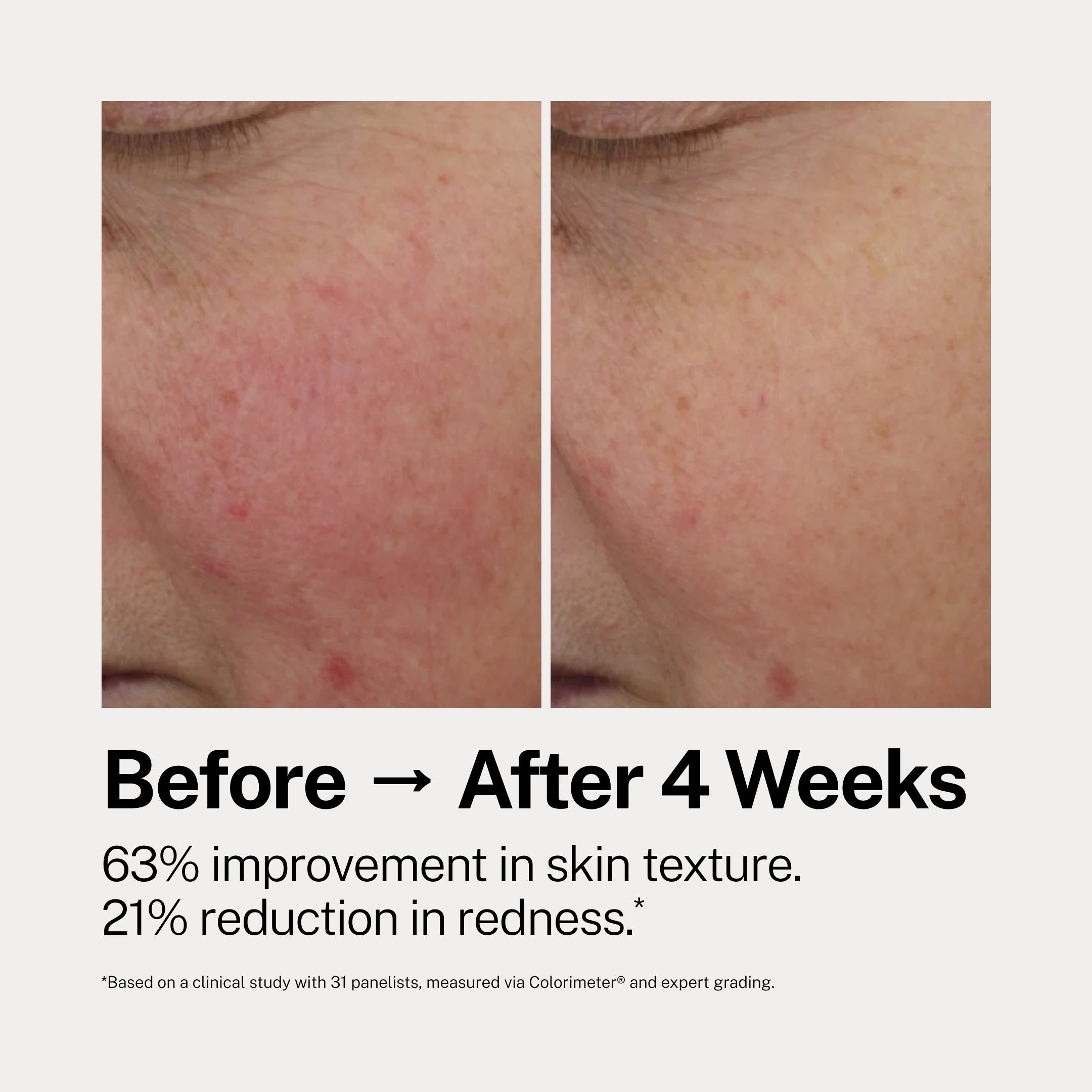 The Catalyst Renewing Serum | Nordstrom