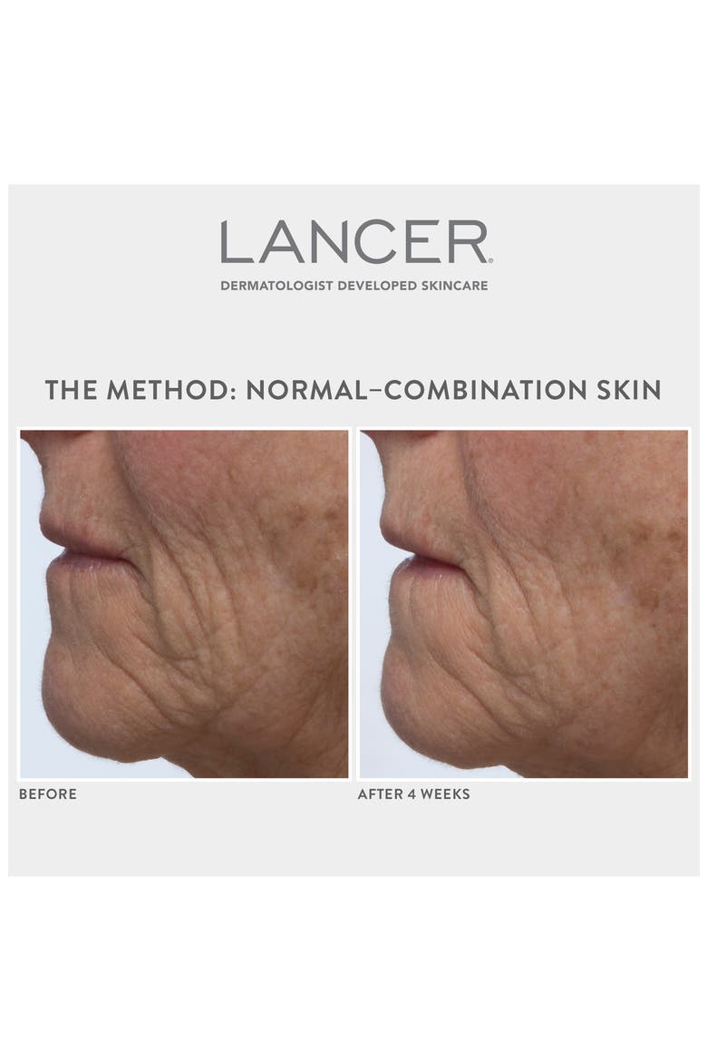Lancer Method Set $270 Value, Alternate, color, NO COLOR