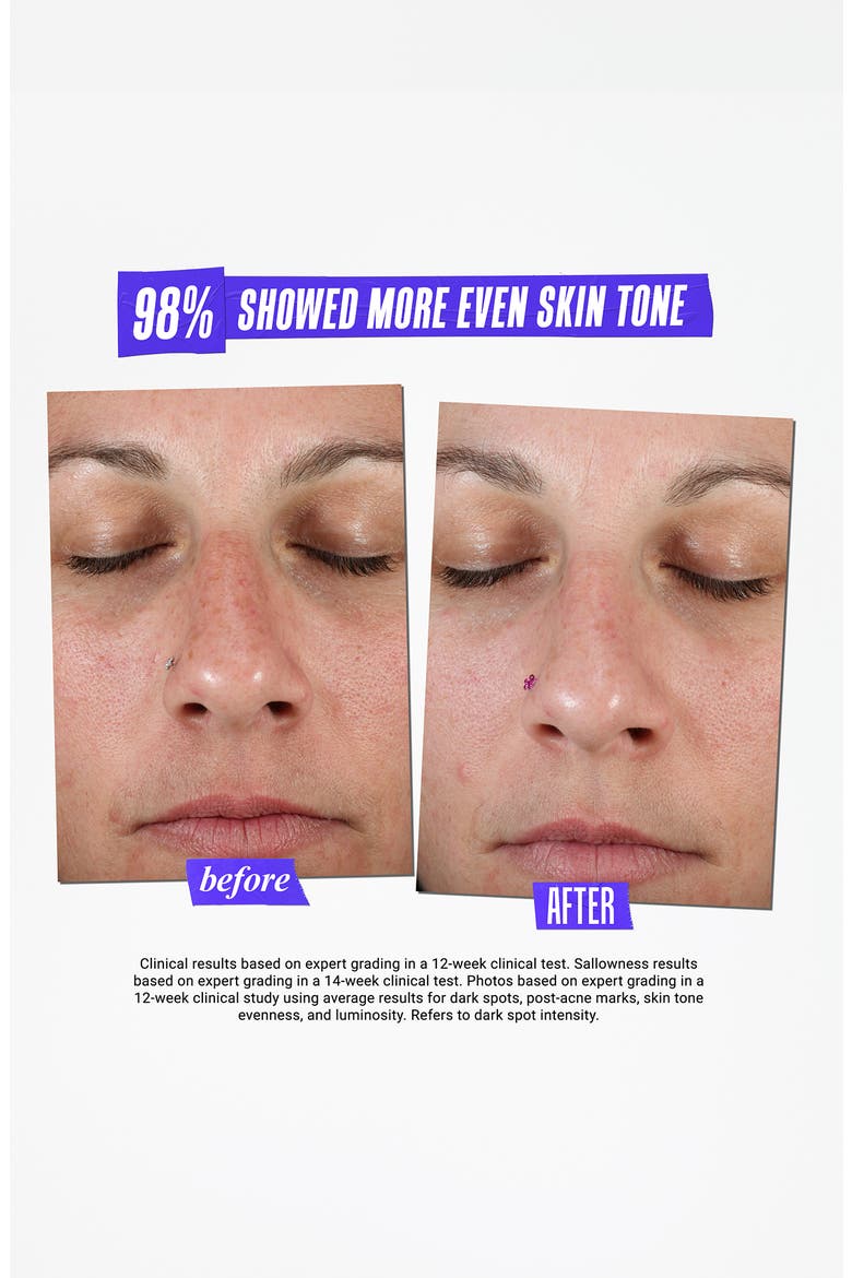 Clearly Corrective™ Dark Spot Solution, Alternate, color, NO COLOR