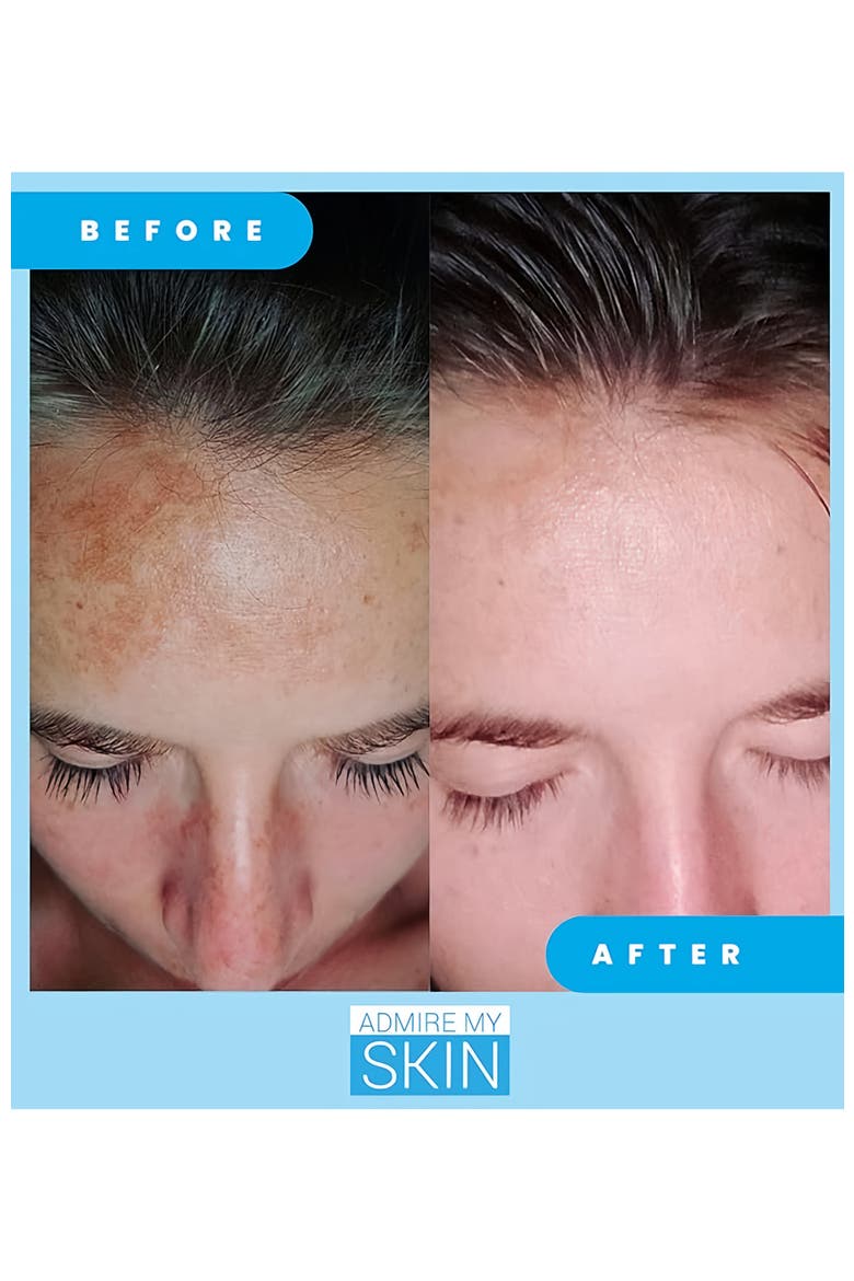 Ultra Potent Brightening Serum Dark Spot Corrector, Alternate, color, Clear