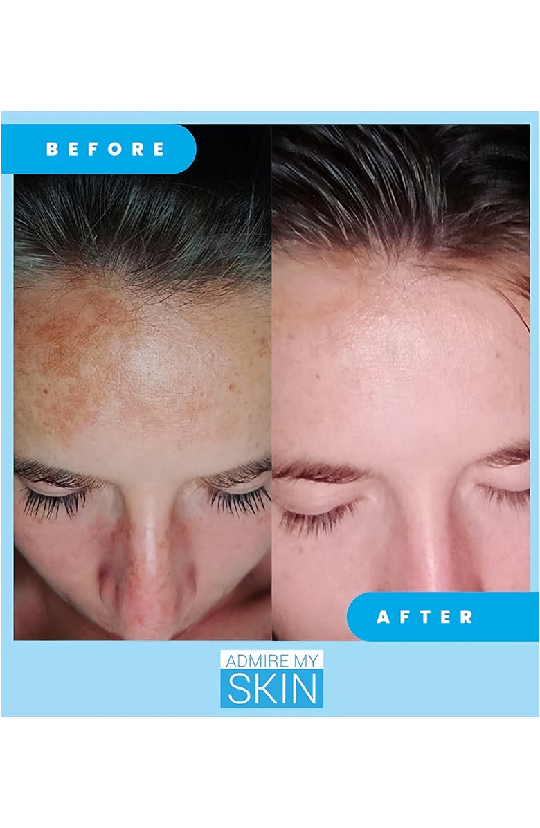 Admire My Skin Ultra Potent Brightening Serum Dark Spot Corrector, Alternate, color, Clear