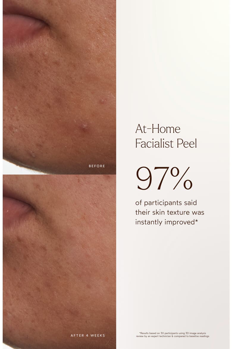At-Home Facialist Peel, Alternate, color, NO COLOR
