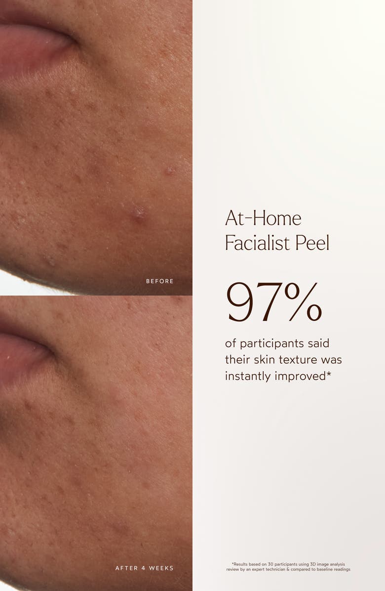 True Botanicals At-Home Facialist Peel, Alternate, color, 