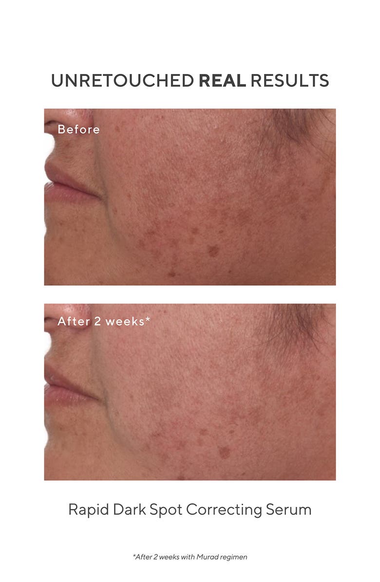 Murad<sup>®</sup> Rapid Dark Spot Correcting Serum, Alternate, color,