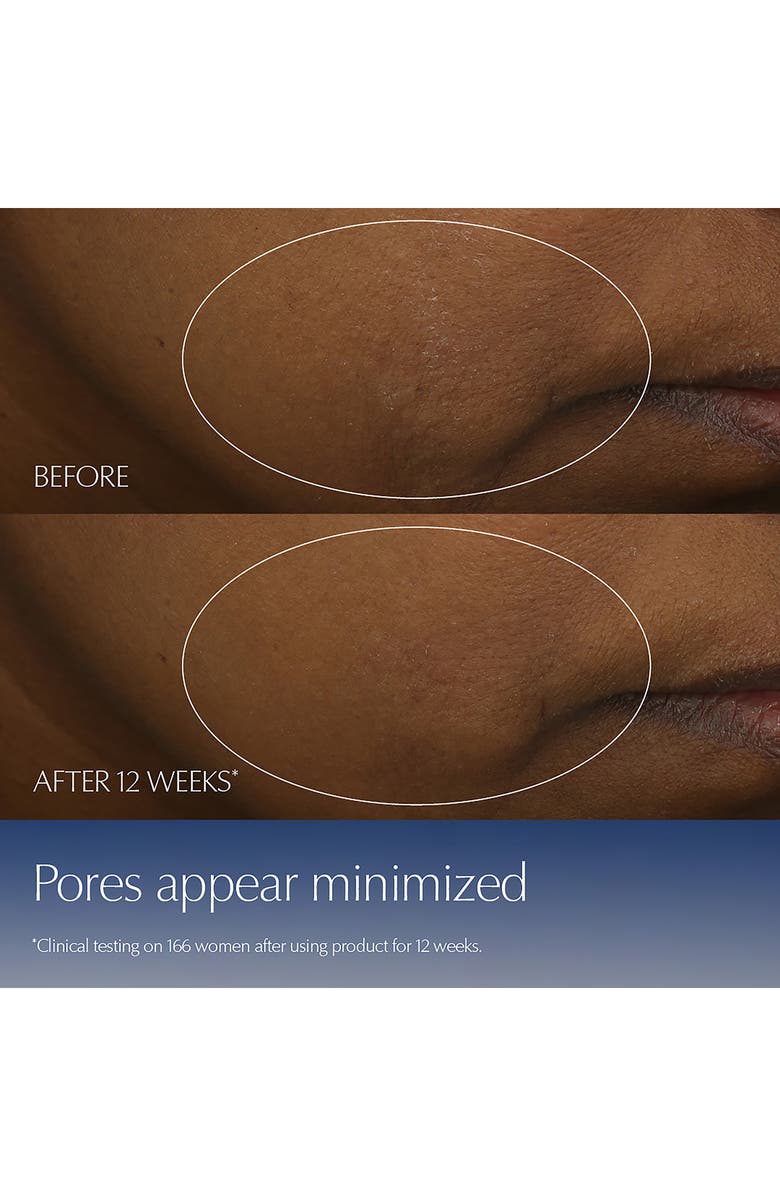 Estée Lauder Advanced Night Repair Synchronized Multi-Recovery Complex Serum with Hyaluronic Acid & Peptides, Alternate, color, 