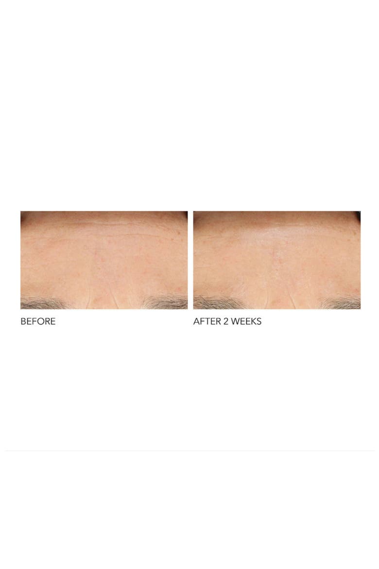 Clinical Grade Resurfacing Liquid Peel, Alternate, color, NO COLOR