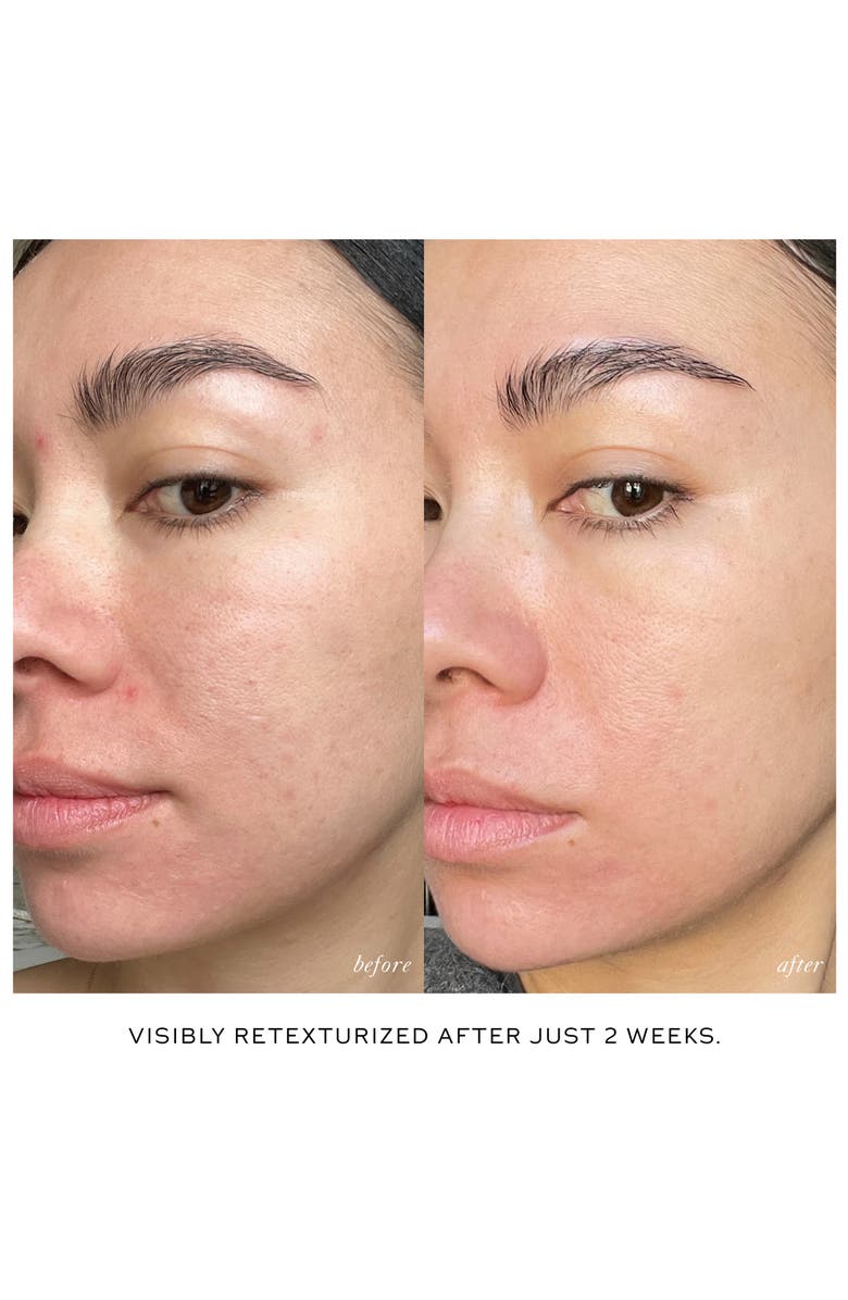 Westman Atelier Skin Activator Rollerball Set, Alternate, color, 