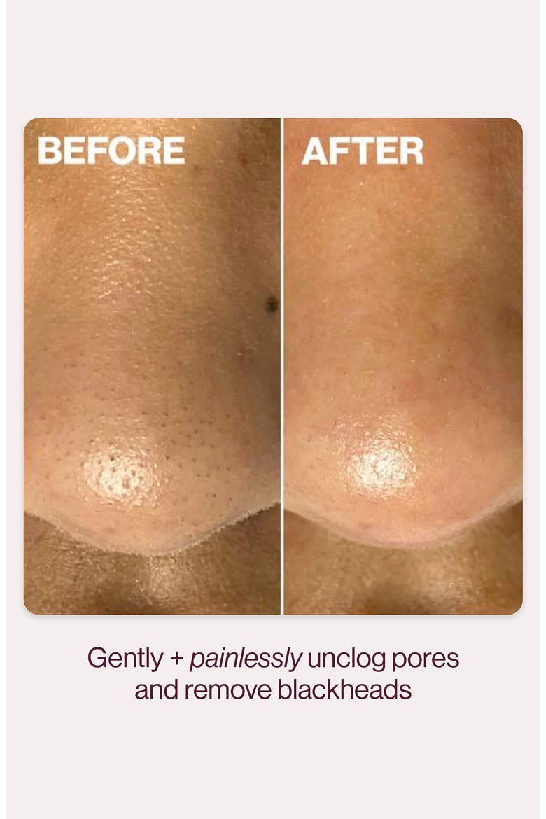 DERMAPORE+ Ultrasonic Pore Extractor + Skincare Infuser, Alternate, color, SEAFOAM