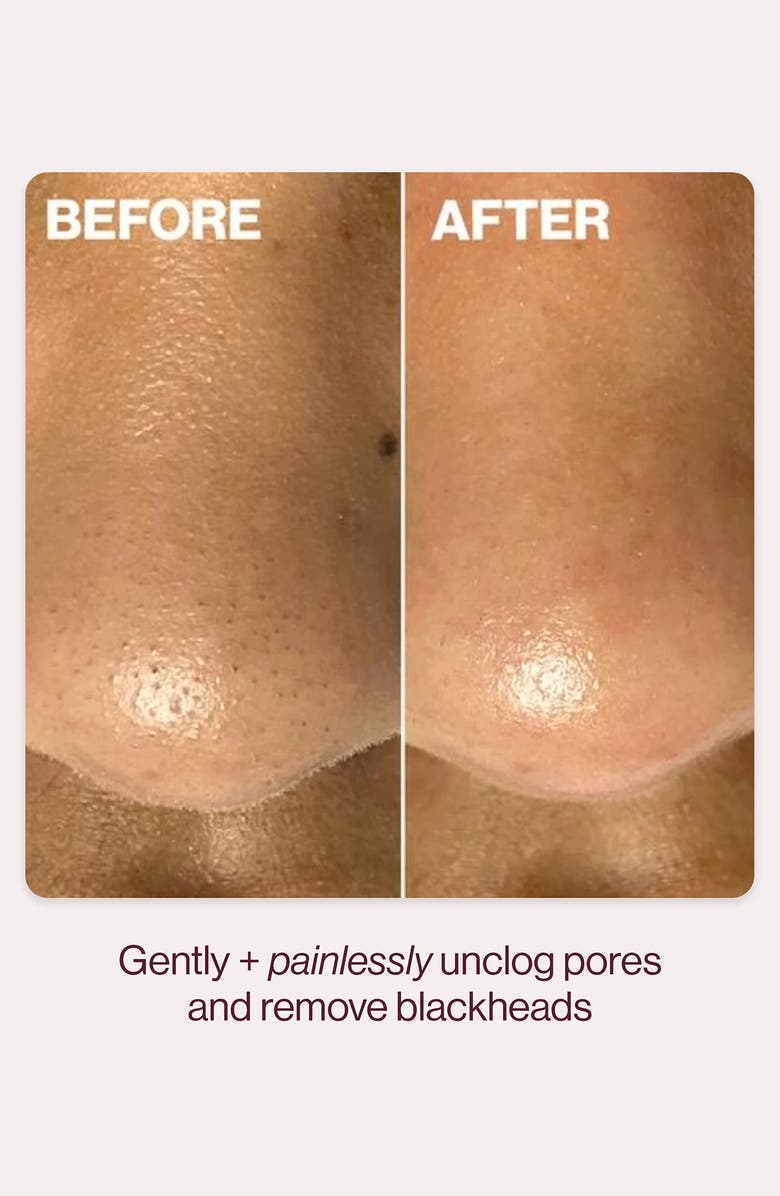 DERMAFLASH DERMAPORE+ Ultrasonic Pore Extractor + Skincare Infuser, Alternate, color, Seafoam