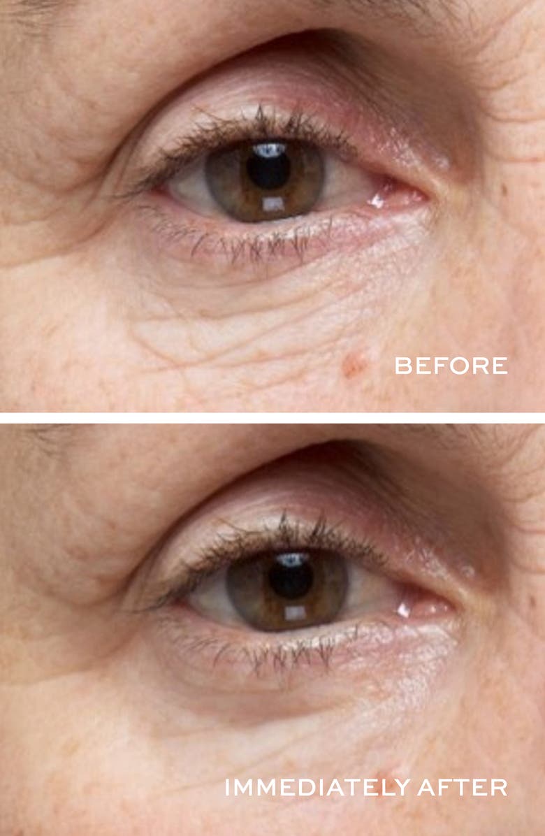 Elemis Pro-Collagen Hydra-Gel Eye Mask, Alternate, color,