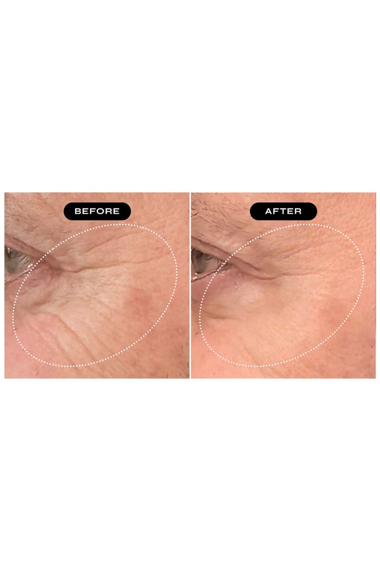 Biopeptide Growth Factor Eye Therapy Serum, Alternate, color, NO COLOR