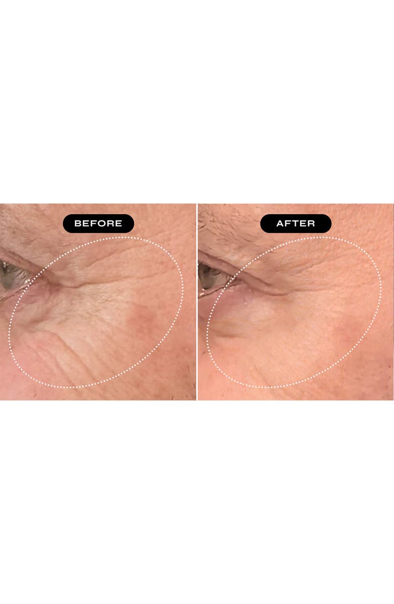 NakedBeauty MD Biopeptide Growth Factor Eye Therapy Serum, Alternate, color, 