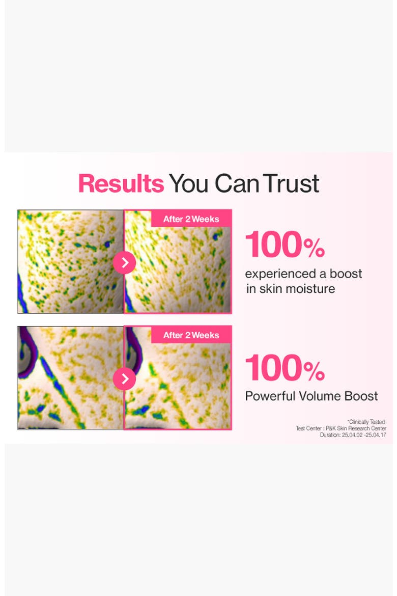5-Pack No.2 Rose PDRN Collagen Sheet Masks, Alternate, color, NO COLOR