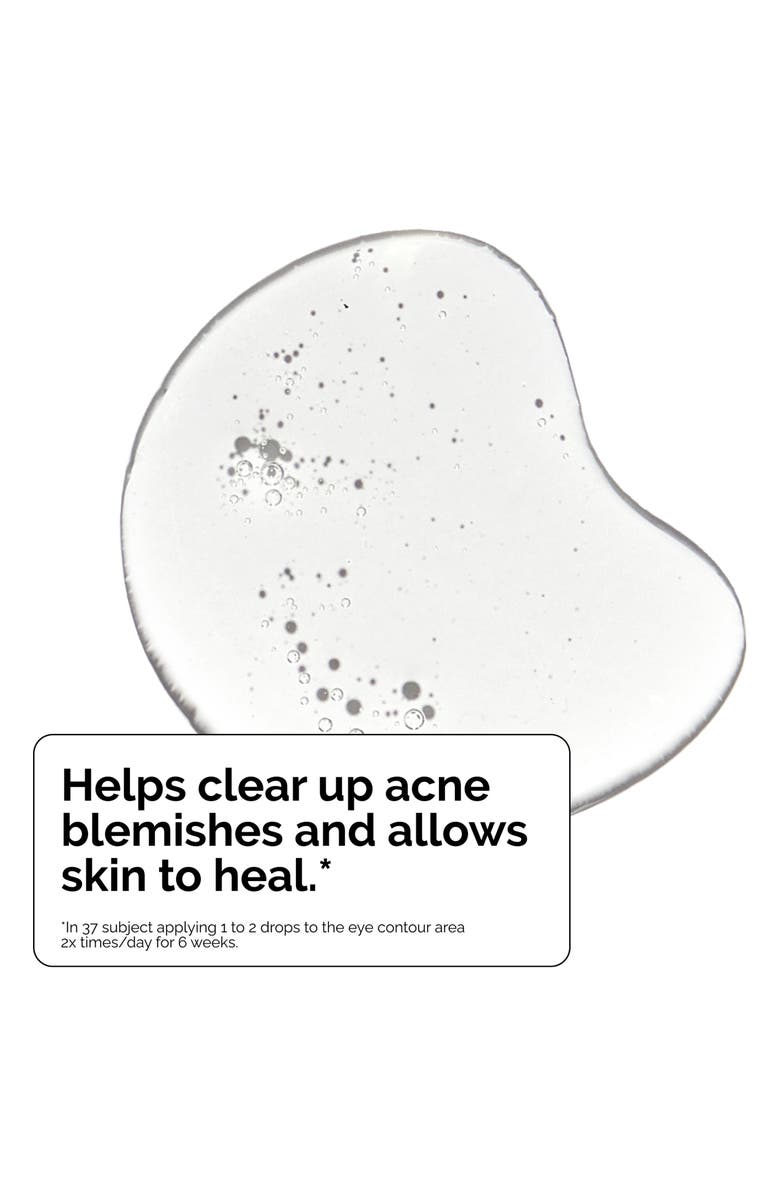 The Ordinary Salicylic Acid 2% Solution, Exfoliating Serum for Acne, Alternate, color, 