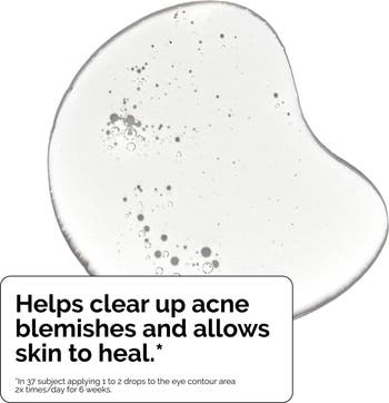 Salicylic Acid 2% Exfoliating Blemish Solution
