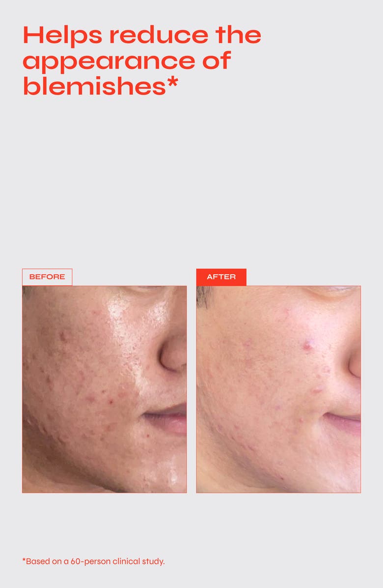 FACILE Reverse 0.2% Retinol Firming Serum, Alternate, color,