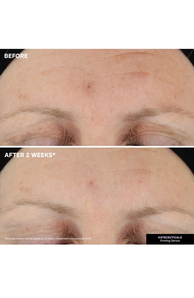 Kate Somerville<sup>®</sup> Kateceuticals<sup>®</sup> Firming Serum, Alternate, color,