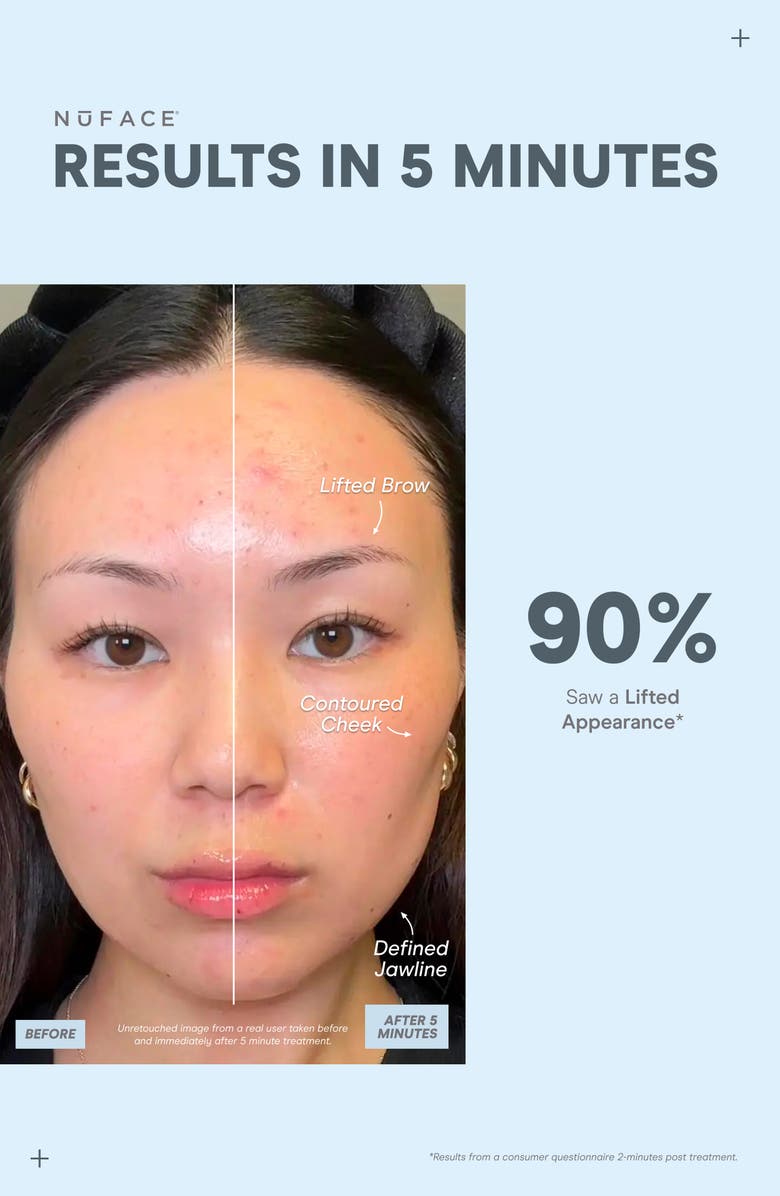 NuFACE<sup>®</sup> MINI+ Smart Petite Microcurrent Facial Toning Device Starter Kit $309 Value, Alternate, color, Sandy Rose