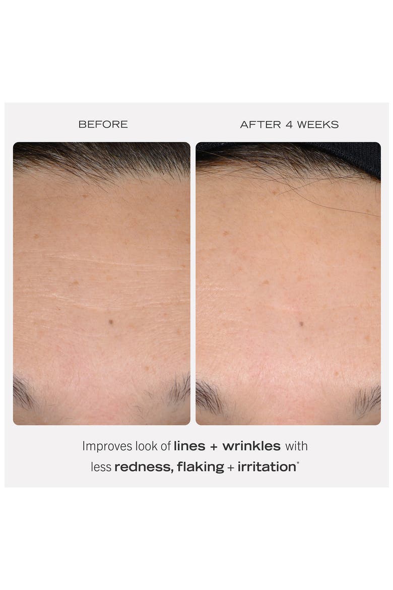 Retinol Complex Serum, Alternate, color, NO COLOR